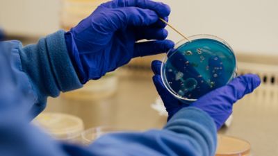 Scientist Examining Bacterial Growth in Petri Dish