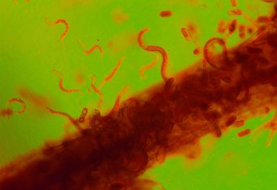 Root Lesion Nematodes