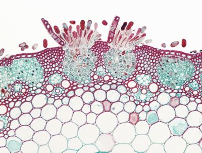 Fighting Back Against Ug99 - Outlook