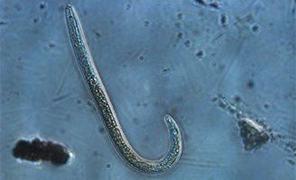 Nematode under microscope
