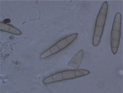 elmintosporiosi del mais