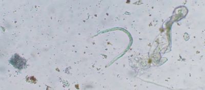 Imagem de nematoides 