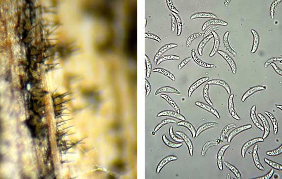 These are side-by-side photos showing anthracnose setae and spores.