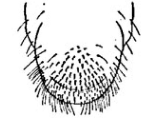 Annual white grub or Masked chafer (1-year grub.)