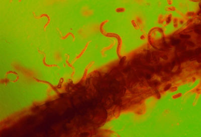 Root Lesion Nematodes