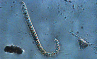 Nematode under microscope