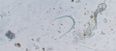 Imagem de nematoides 