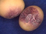 Photo: Soybean seeds showing purple seed stain caused by infection with Cercospora kikuchii.