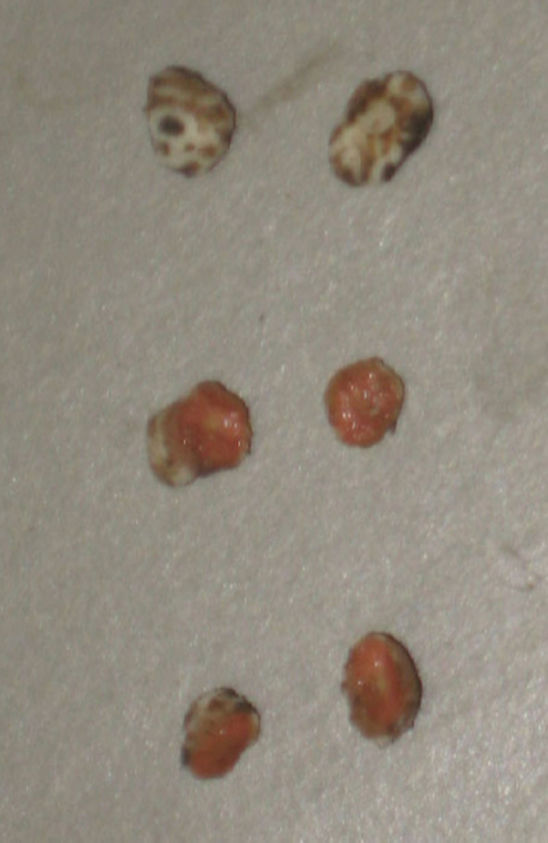 Healthy soybean root nodules that are actively fixing nitrogen are pink or red inside.